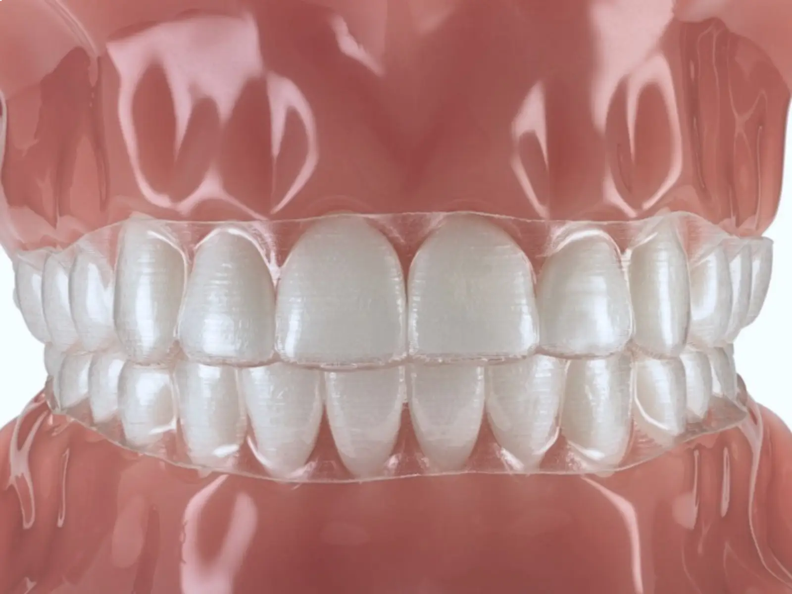 allineamento denti savona 9